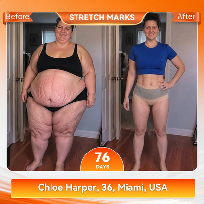 𝐎𝐟𝐟𝐢𝐜𝐢𝐚𝐥 𝐁𝐫𝐚𝐧𝐝 𝐒𝐭𝐨𝐫𝐞 🇺🇸| 𝐂𝐥𝐞𝐚𝐫𝐞𝐧𝐚® 𝟐𝟎𝟐𝟔 𝐌𝐨𝐫𝐢𝐧𝐠𝐚 x 𝐁𝐞𝐫𝐛𝐞𝐫𝐢𝐧𝐞 x 𝐍𝐀𝐃+ 𝟔-𝐈𝐧-𝟏 𝐌𝐢𝐜𝐫𝐨-𝐏𝐚𝐫𝐭𝐢𝐜𝐥𝐞 𝐒𝐜𝐮𝐥𝐩𝐭𝐢𝐧𝐠 & 𝐅𝐚𝐭-𝐁𝐮𝐫𝐧 𝐒𝐡𝐨𝐫𝐭𝐬 (Women + Men with Enhanced Male Vitality Blend) (Copy)